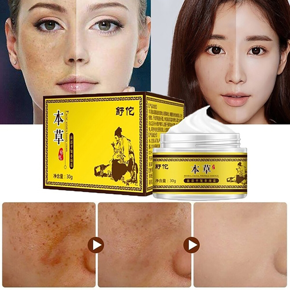 AWEI1 30g Brightening Dark Spot Freckle Removal Cream Facial Care Melasma Treatment