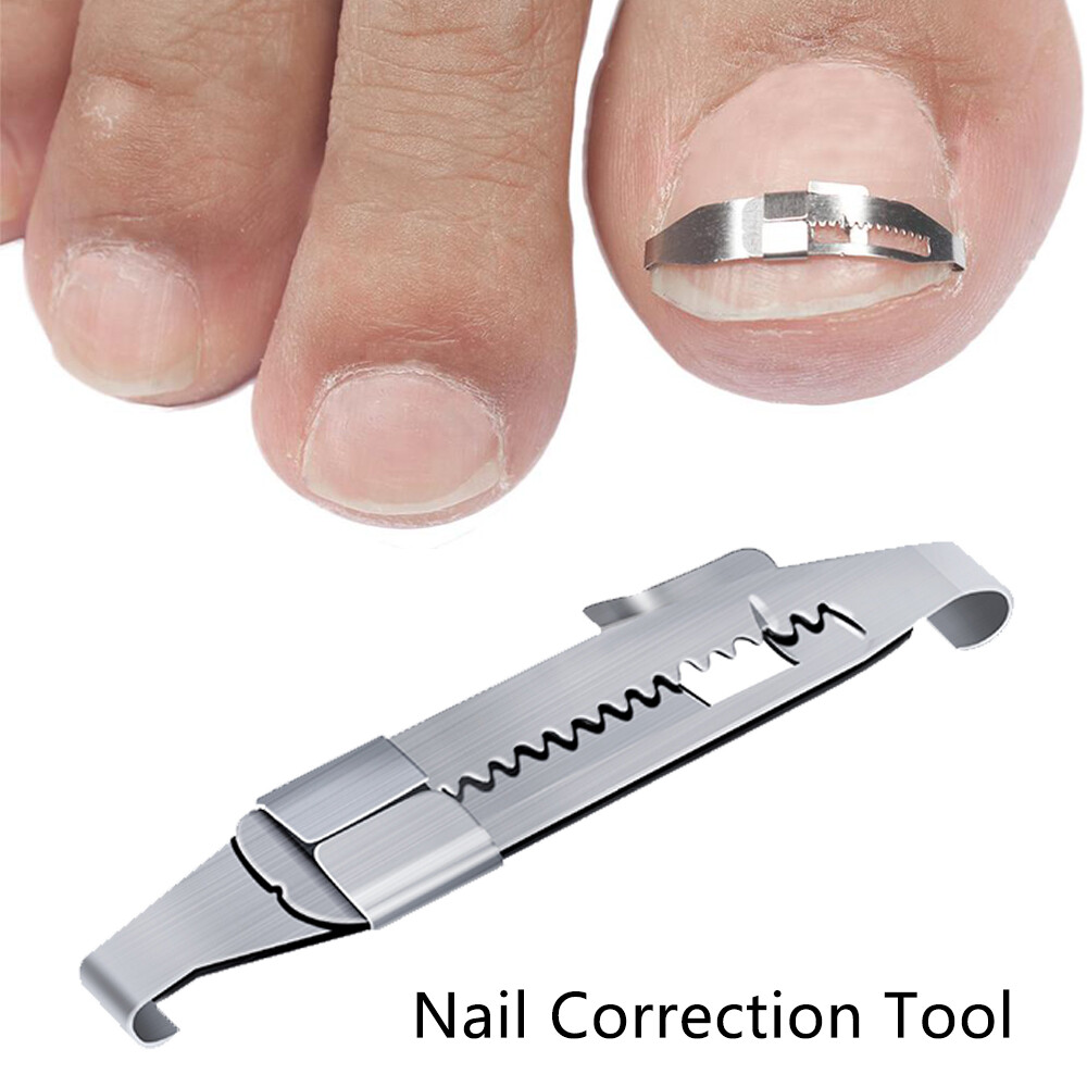 Ingrown Toe Nail Correction Tool Toenail Straightening Correctors Patch Tool