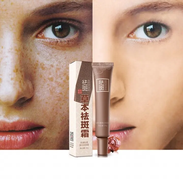anti dark spot cream for face