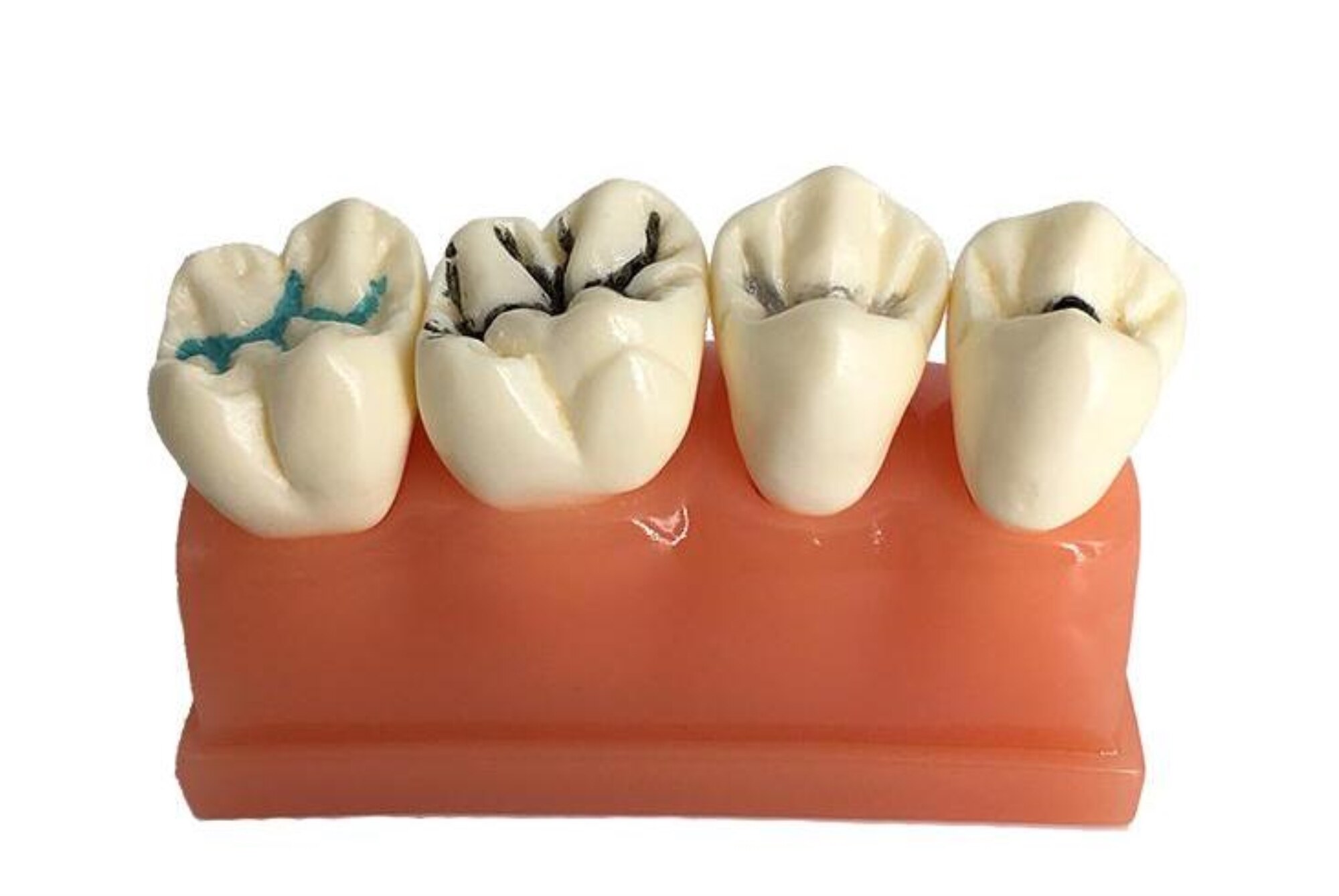 Dental oral teaching model dentist doctor patient communication tooth