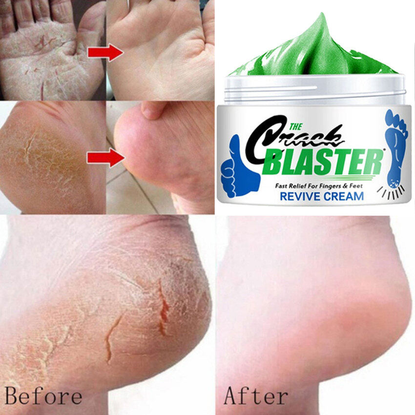 Kem chống nứt chân tay 15/30/50g chống khô phục hồi nứt gót chân loại bỏ da chết - INTL