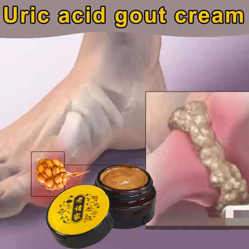 Gout Treatment Cream Pain Relief gout uric acid medicine Gout Leg Joint
