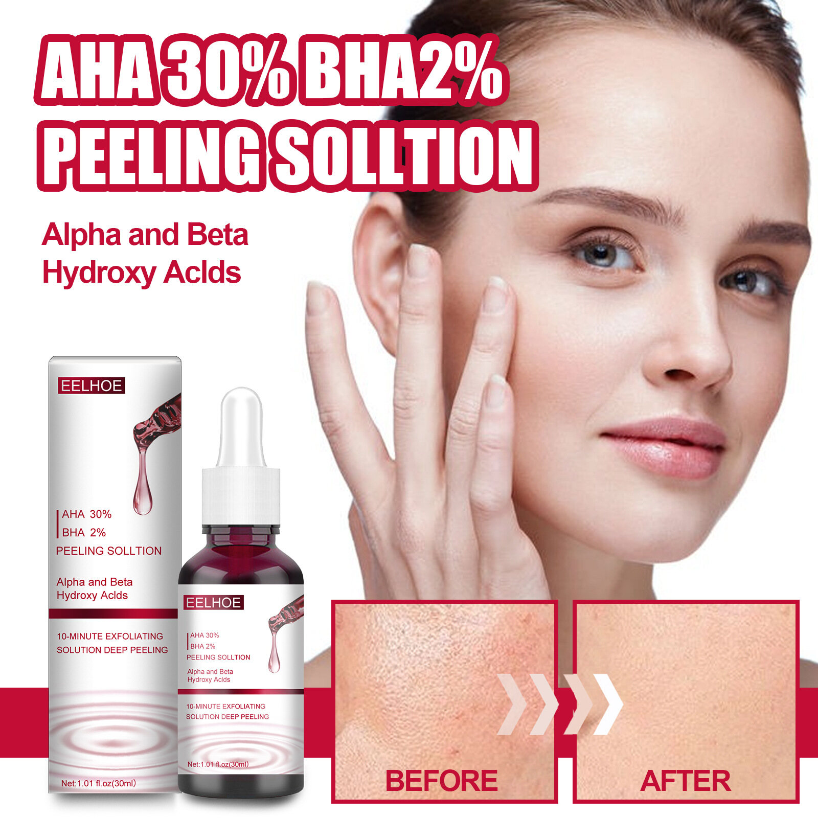 Eelhoe Fruit Acid Salicylic Acid Essence AHA 30%+ BHA 2% Remove Acne Scars Closed Blackhead Serum Shrink pores Whitening Exfoliating Beauty Moisturizer Anti-Aging Face Essence Care（30ml）