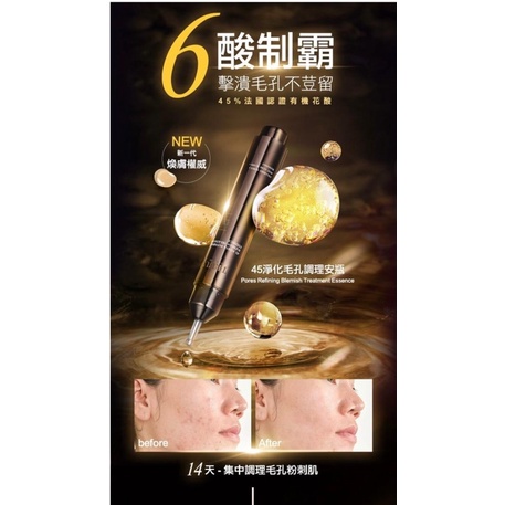 TRUU 0 | Blemish Refining Treatment Pores Essence 10ML Lazada 童