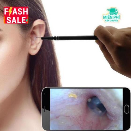 Dụng cụ lấy ráy tai tích hợp camera mini thông minh