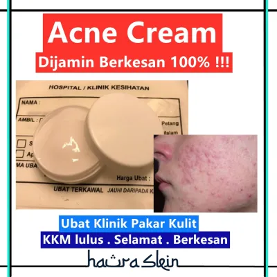 Krim Jerawat 10gm Acne Cream dari Klinik Pakar Kulit Terkenal terbukti berkesan