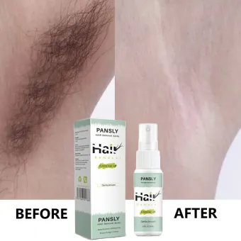 100 Original Ready Stock Cod 30ml Permanant Hair Growth Removal
