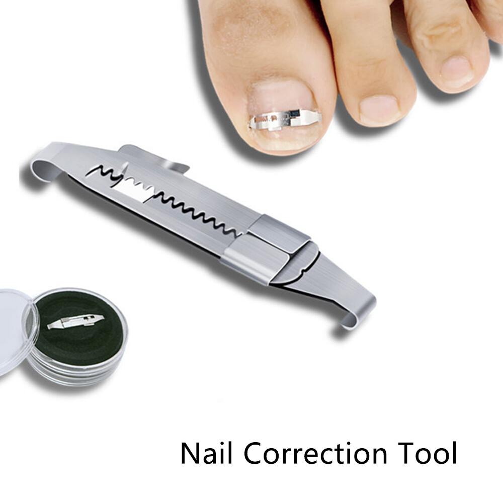 Ingrown Toe Nail Correction Tool Toenail Straightening Correctors Patch Tool