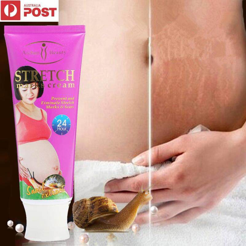 120g Kem Loại Bỏ Sẹo Rạn da Chăm Sóc Sau Sinh Đồ Da Cơ Thể Sửa Chữa Chăm Sóc cao cấp