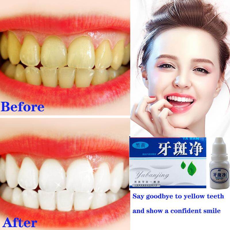 1 Bottle 10 Ml Teeth Cleaning Mouth Cleaning Liquid Teeth Bleaching Tools