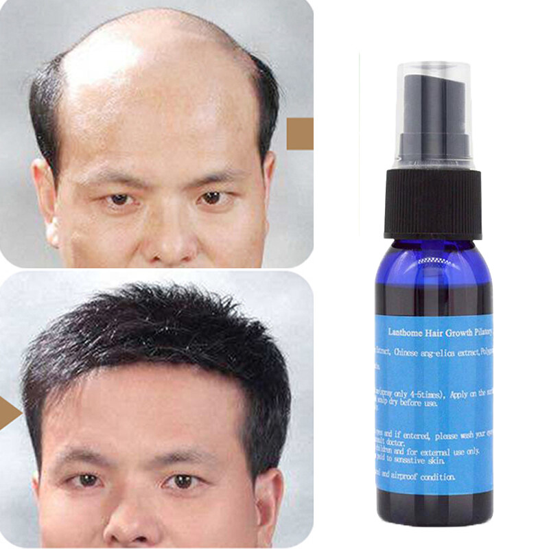 Shipping In 24 Hours Unique Fast Sunburst Hair Growth Products