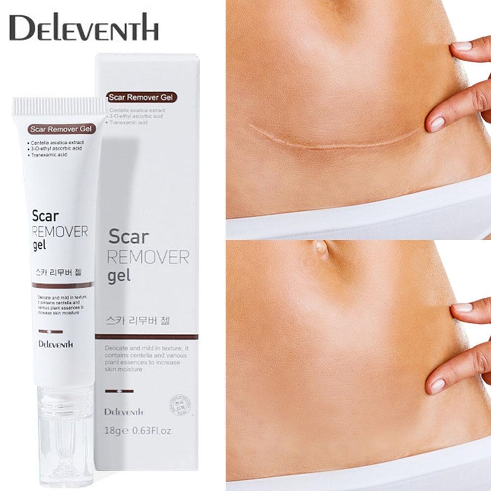 Aliver Repair Scar Scar Cream Remove Stretch Mark Scald Caesarean Bump Surgery Scar ครีมลดรอย 5523