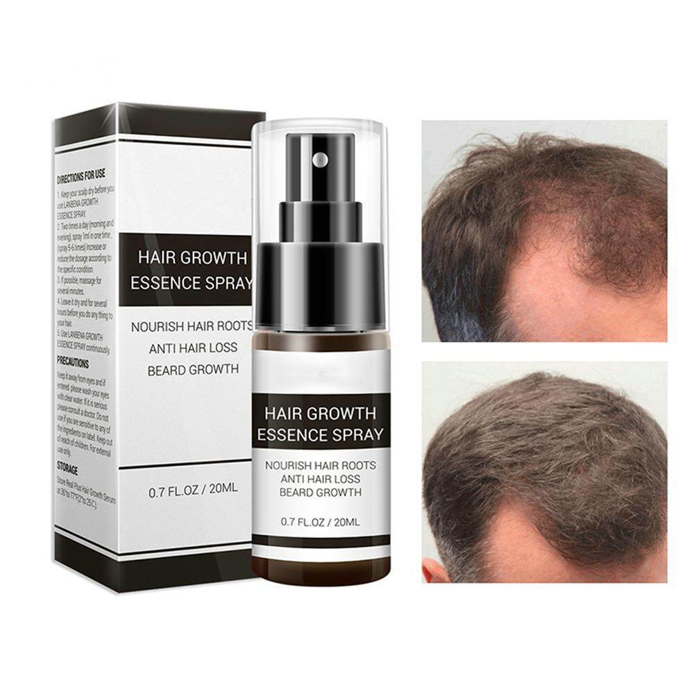 Aolvo Fast Natural Hair Growth Spray Dense Liquid Essence Hair
