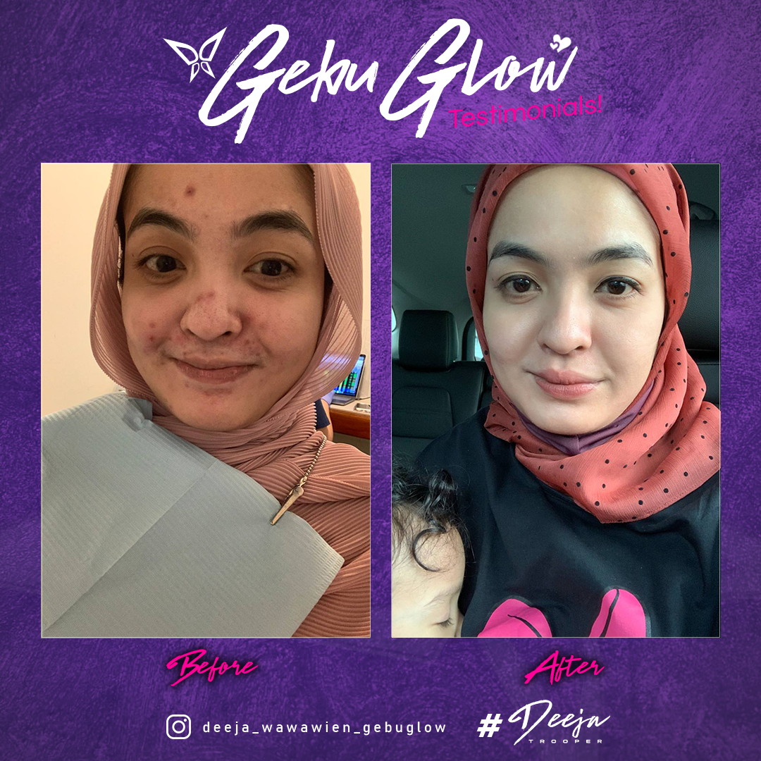 4 Gebu Glow Vitamin C By Wawawien Beaute Geboo Vita C Glow Free Gift 100g X 4 Lazada