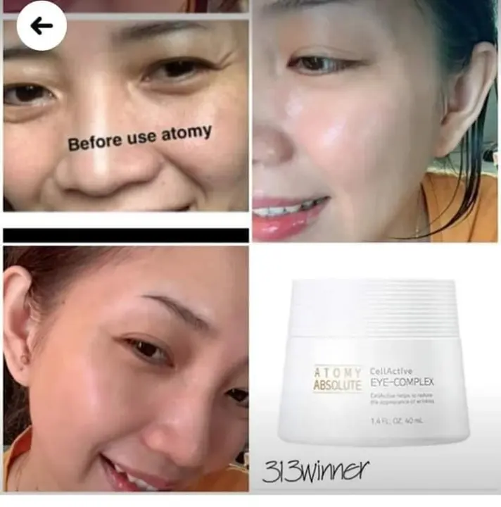 atomy absolute spot out cream