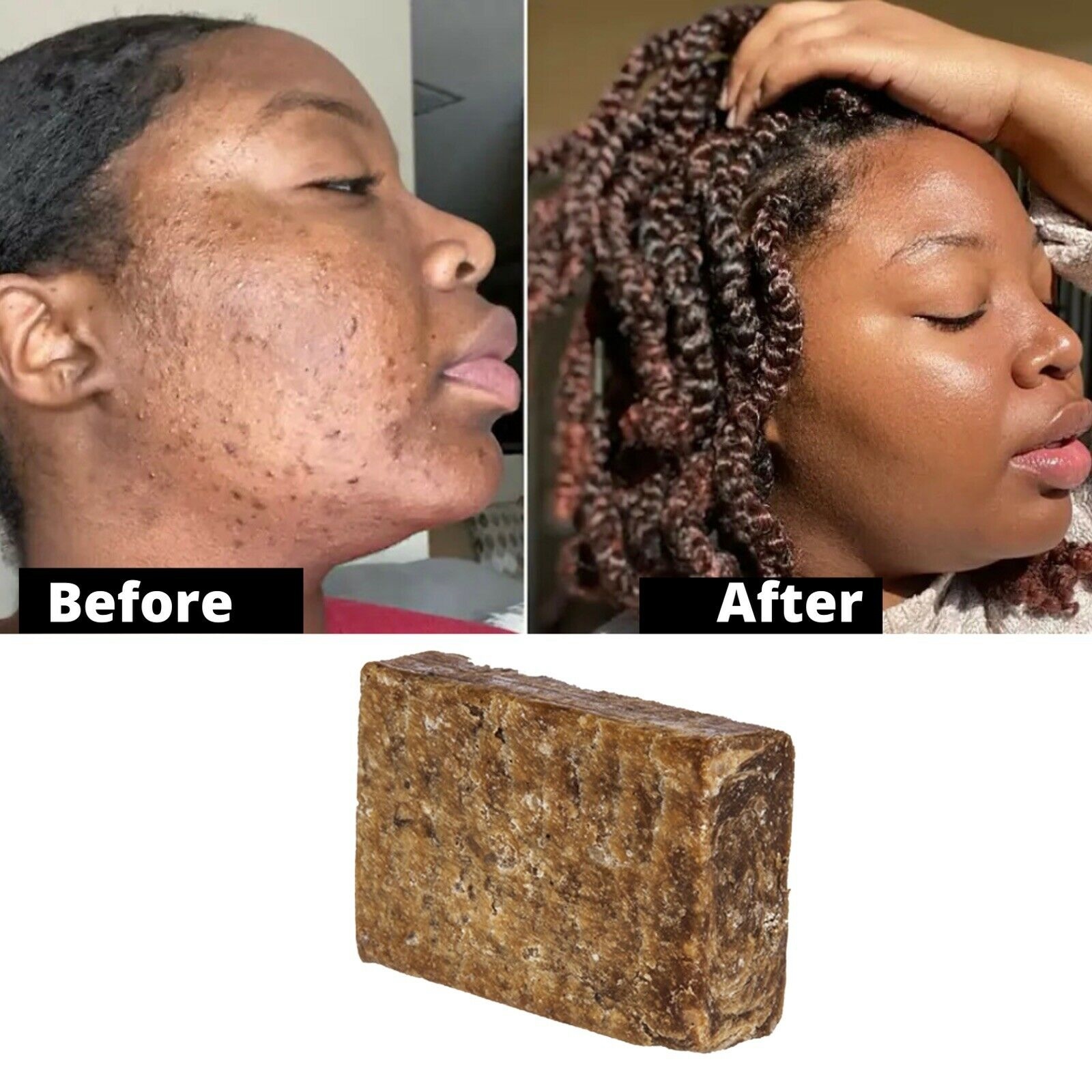 Original African Black Soap Dark Spots Remover Acne Clear Skin 100g