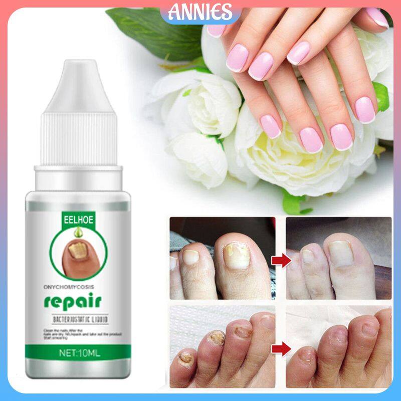 Annies Ml Nail Treatment Serum Nail Care Oil Broken Nail Repair Essence