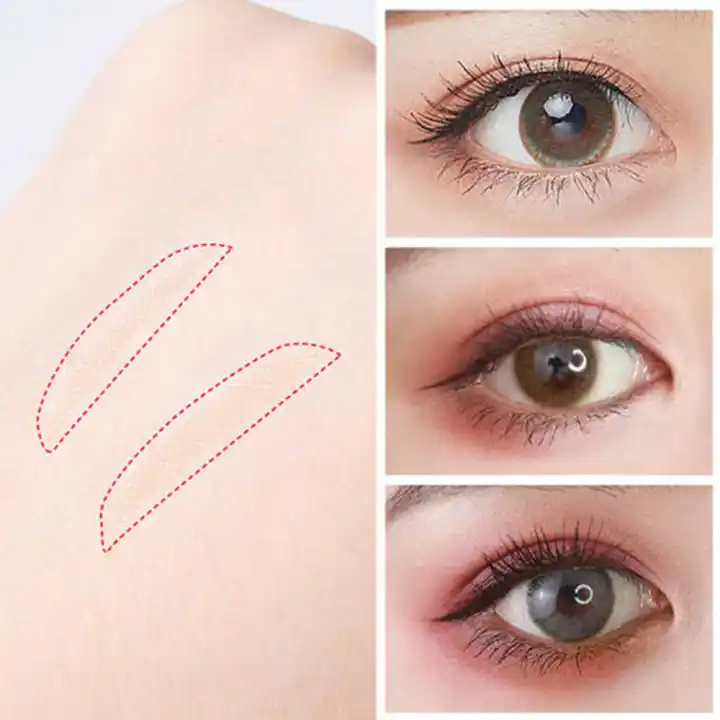 deep double eyelids