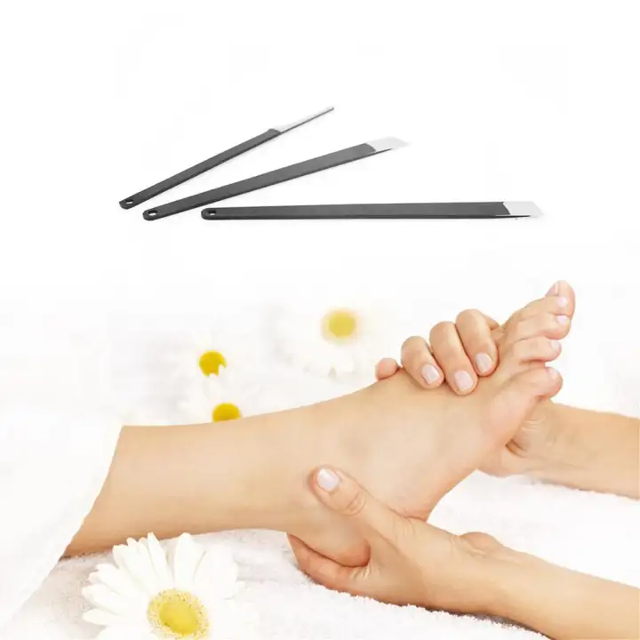 ingrown corn on foot