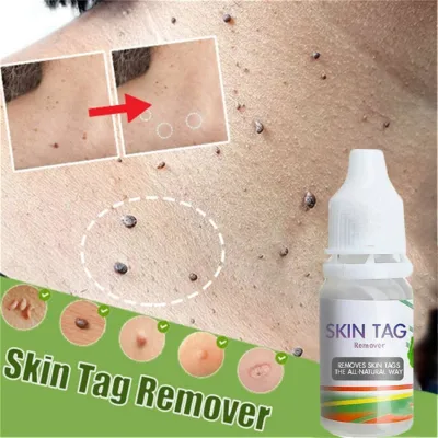 10ml Skin Tag Remover Liquid Foot Care Cream Skin Tags Genital Wart Remover Treatment Foot Corn Removal