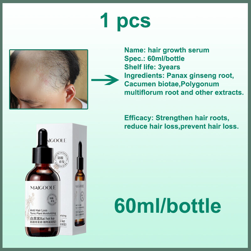 Hair Growth Serum Anti Hair Loss Hair Growth Solution 60g Hair Loss