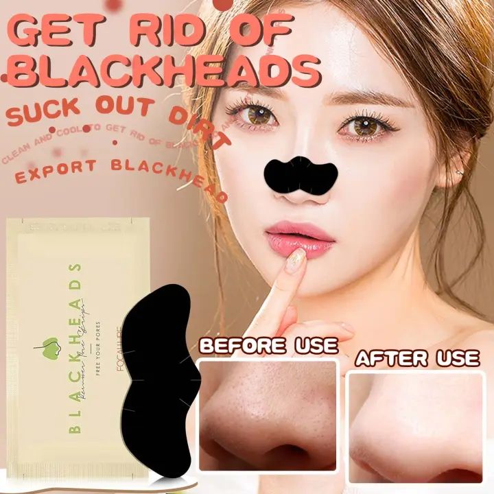 blackheads on nose 2021