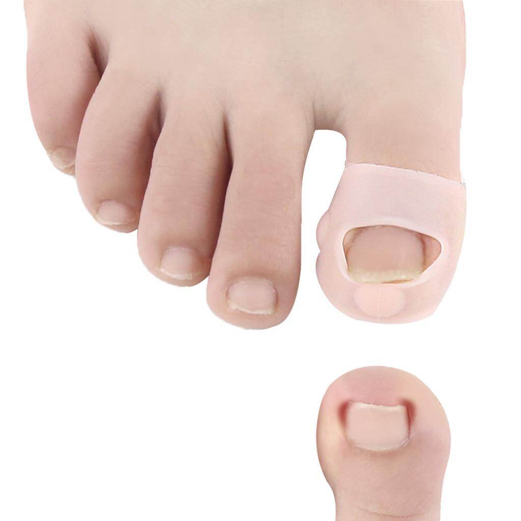 Ingrown Toenails Band Aid Relief Pain Paronychia Correction Pedicure