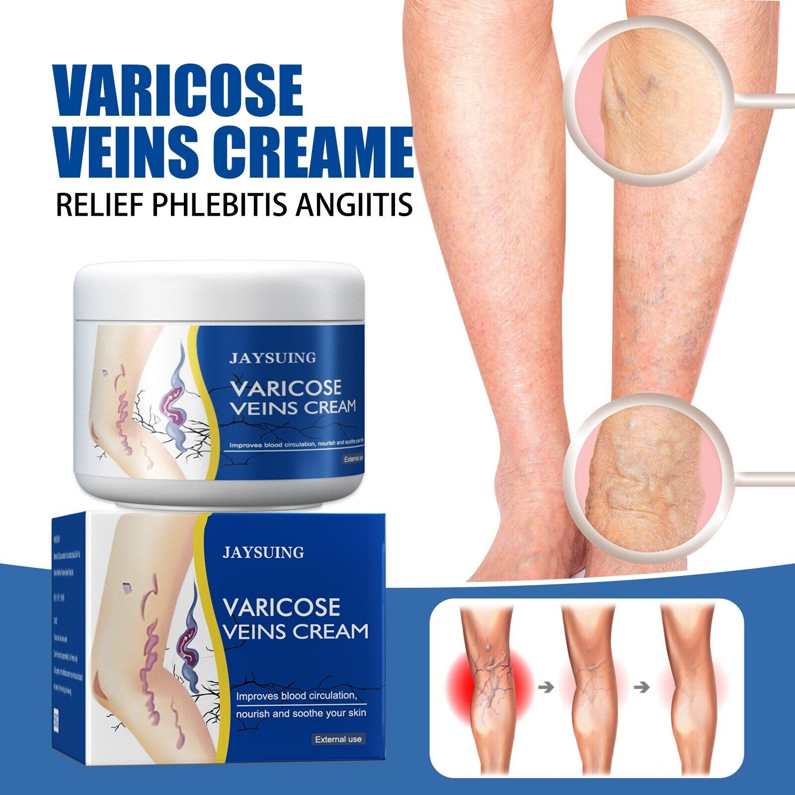 Jaysuing leg venous repair massage cream varicose earthworm leg pain