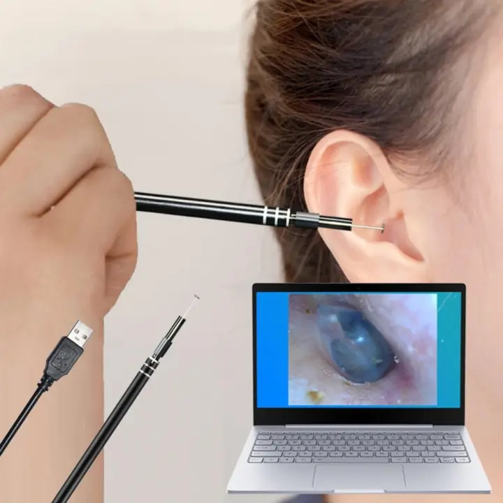 micro ear as seen on tv