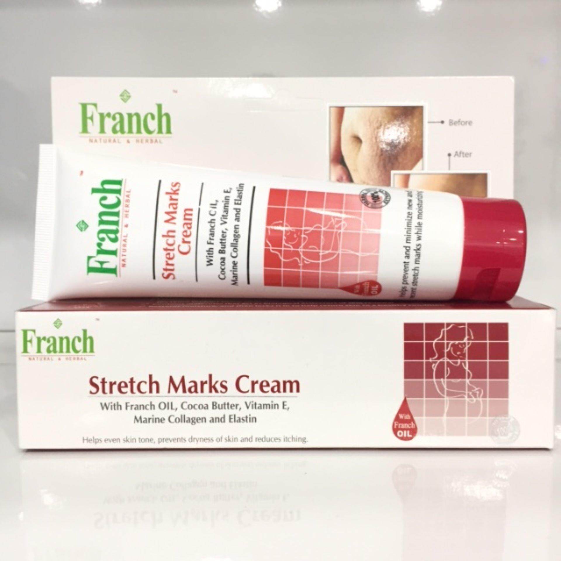 franch stretch marks cream