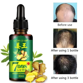 Ready Stock Hair Growth Ginger Germinal Oil Ginger Hair Growth
