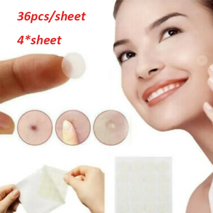 Crazylife 144 Pcs Professional Skin Tag Remover Patch Ance Pimple Patch Plaster Lazada