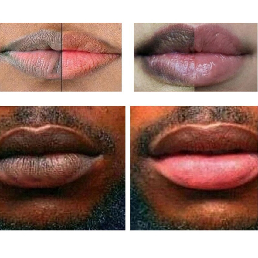 Magic Lip Lighten Chà màu đen sẫm Loại Bỏ Môi Tẩy Tế Bào Chết Sắc Tố Phai Mờ Màu Hồng Son Dưỡng Môi Làm Sáng Chống Nứt Giữ Ẩm