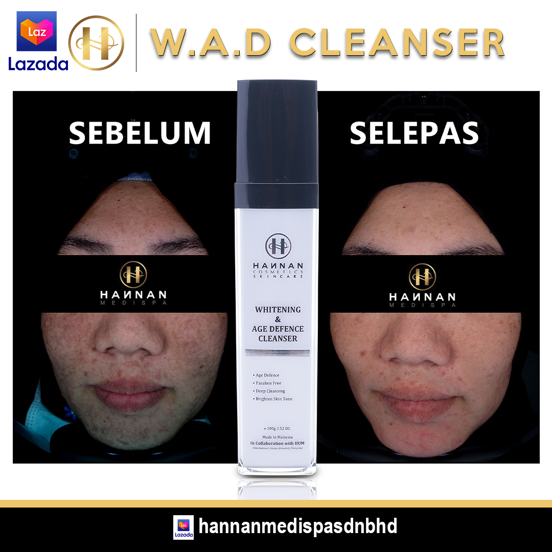 Whitening Age Defense Cleanser Hannan Medispa Skincare Lazada