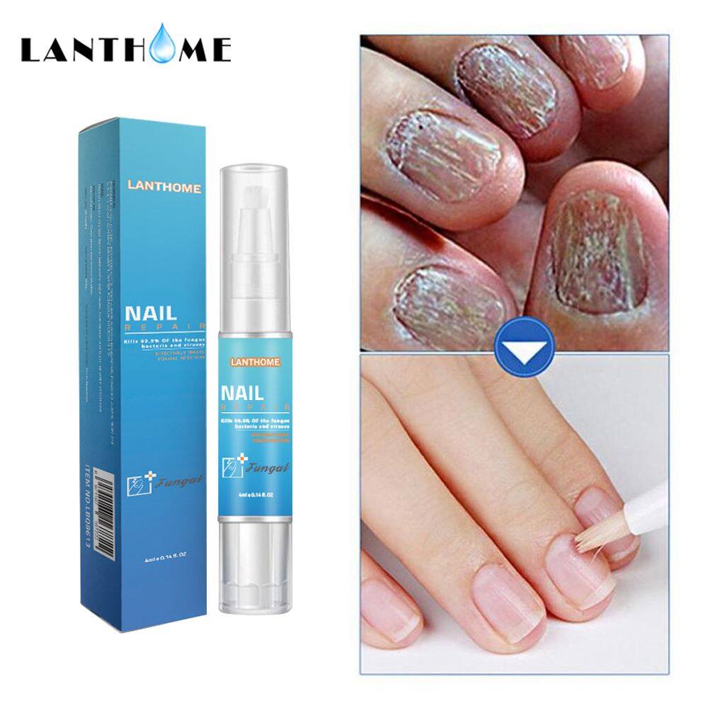 Lanthome Nail Pen Repair Damaged Nails Nail Fungus Treatment Solution 4ml Lazada PH