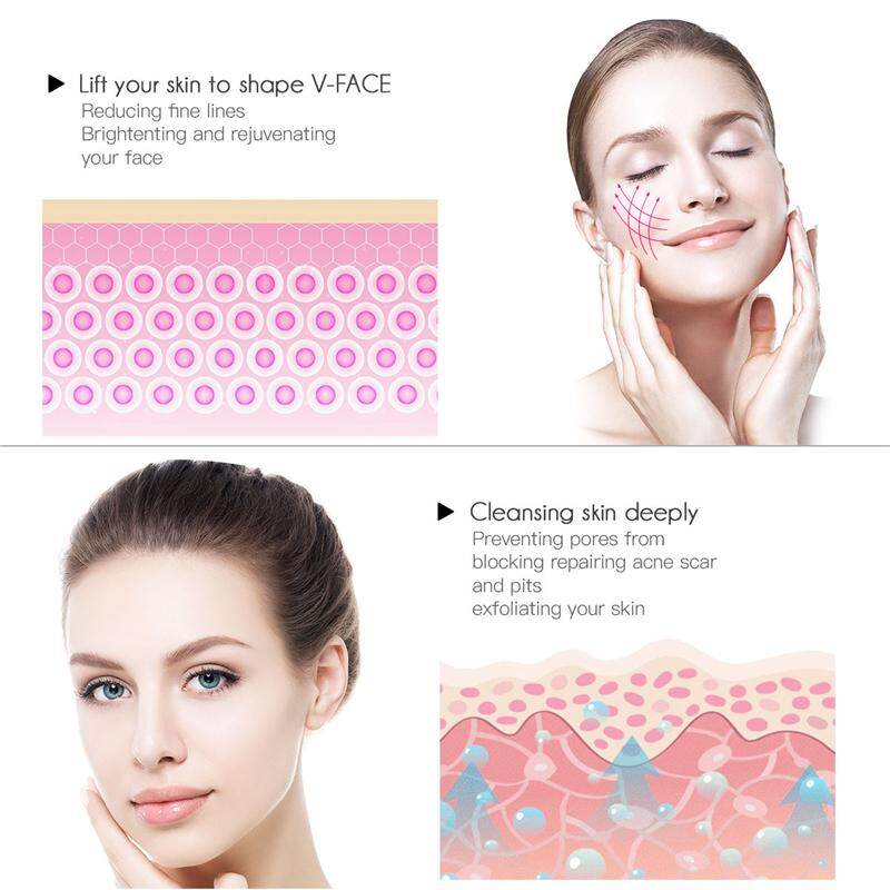 CkeyiN USB Rechargeable Vacuum Suction Blackhead Remover Facial Pore