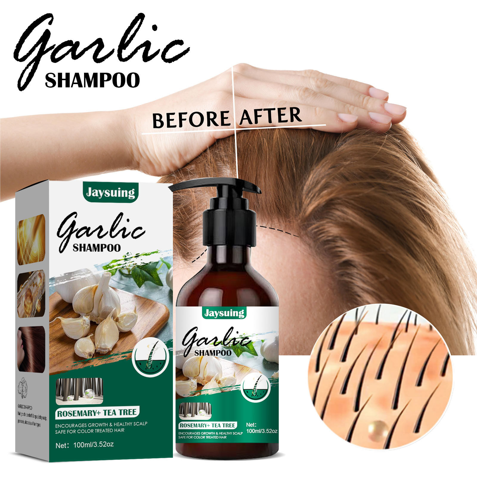 Scalp AntiDandruff Shampoothing Damaged Garlic AntiDandruff 100ML