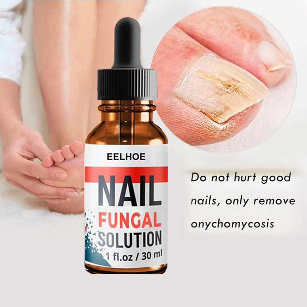 BÁO GIÁ CHĂM SÓC MÓNG TAY MỚI | Shopee Lazada Sendo Tiki mới nhất 24 Erya Tinh Chất Phục Hồi Chân 10 ML Gel Loại Bỏ Nấm Móng Chân Làm Trắng Chăm Sóc Móng Tay Dung Dịch Phục Hồi Chống Nhiễm Trùng Tinh Chất Chống Nấm Thúc Đẩy Tăng Trưởng Sàn Mới Dung Dịch Kháng Khuẩn Điều Trị Móng Nhiễm Trùng Nấm Móng Paronychia