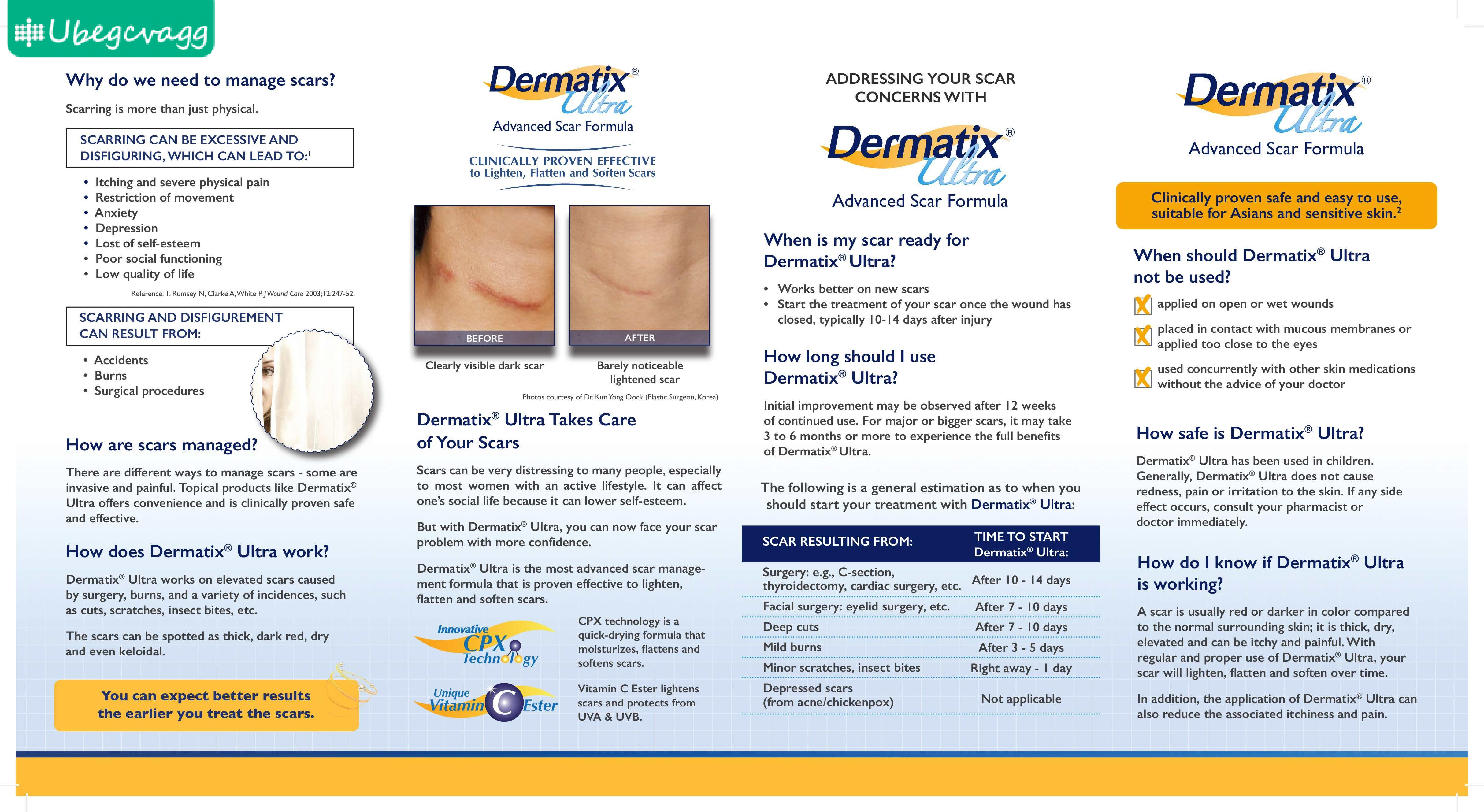 Dermatix Ultra Advanced Scar Formula Gel 15g Lazada Singapore