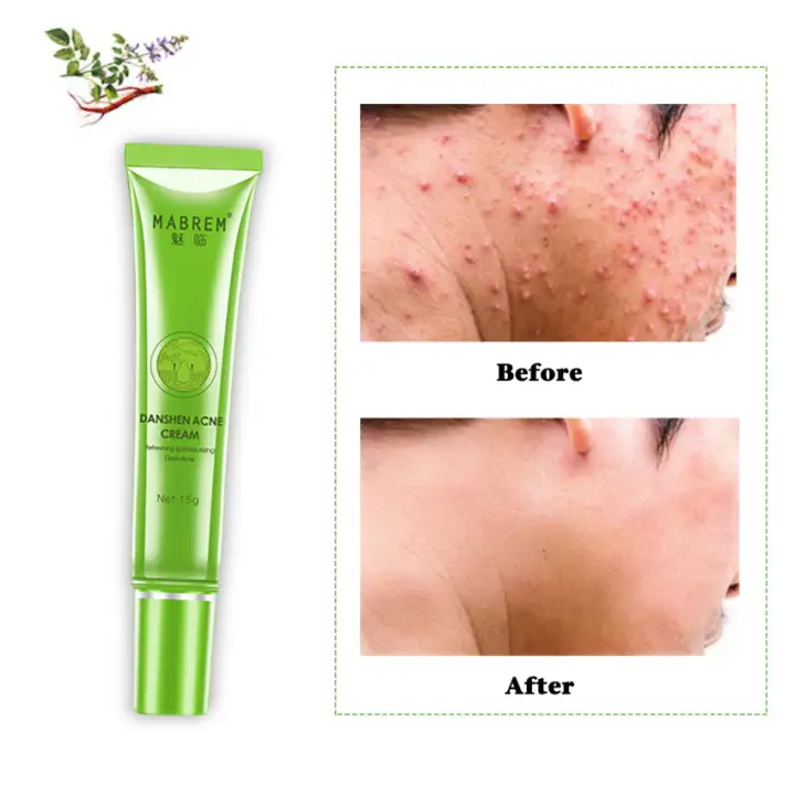 danshen acne cream