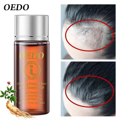 OEDO 20ML Hair Growth Oil Preventing Hair Loss Liquid Damage Hair Repair Treatment Dense Restoration Hair Growth