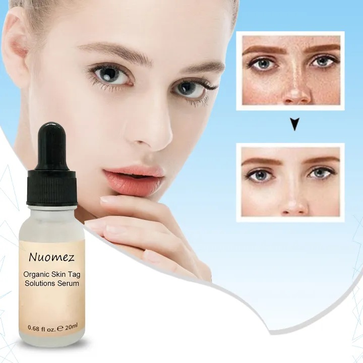 organic skin tag solution serum