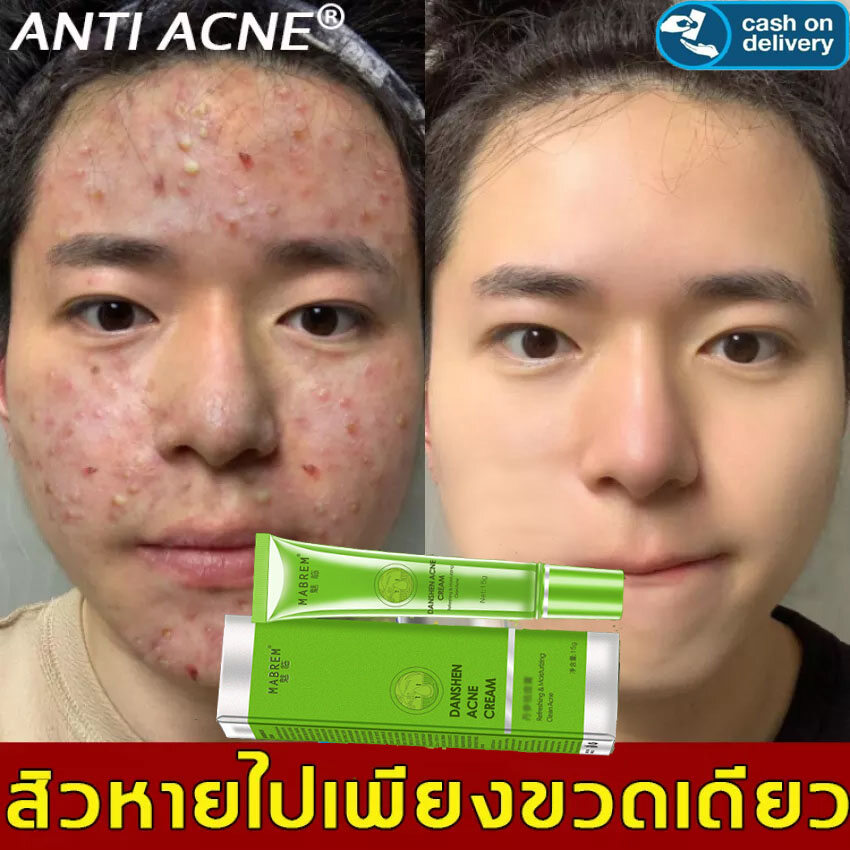 danshen acne cream