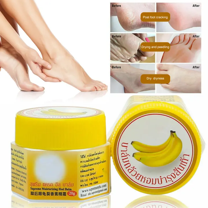 Mofajiang Natural Banana Peel Extract Foot Hand Skin Crack Repair Balm Cream Banana Oil Moisturizing Cracked Heel Heeling Skin Repair Cream For Dry Feet And Hands Lazada Singapore