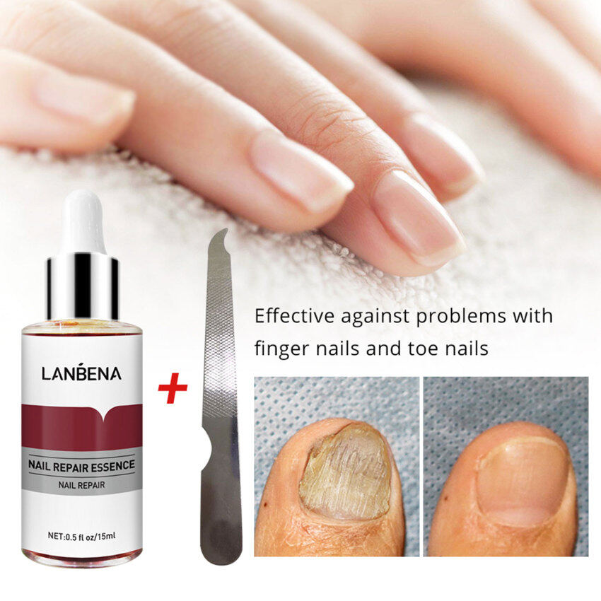 LANBENA Nail Repair Essence Serum Fungal Nail Treatment Remove Onychomycosis Toe Nourishing Brighten Hand Foot Skin Care 12ml