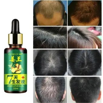 24 Hours Ship 30ml Chinese Herbal Formula Prevent Hair Growth