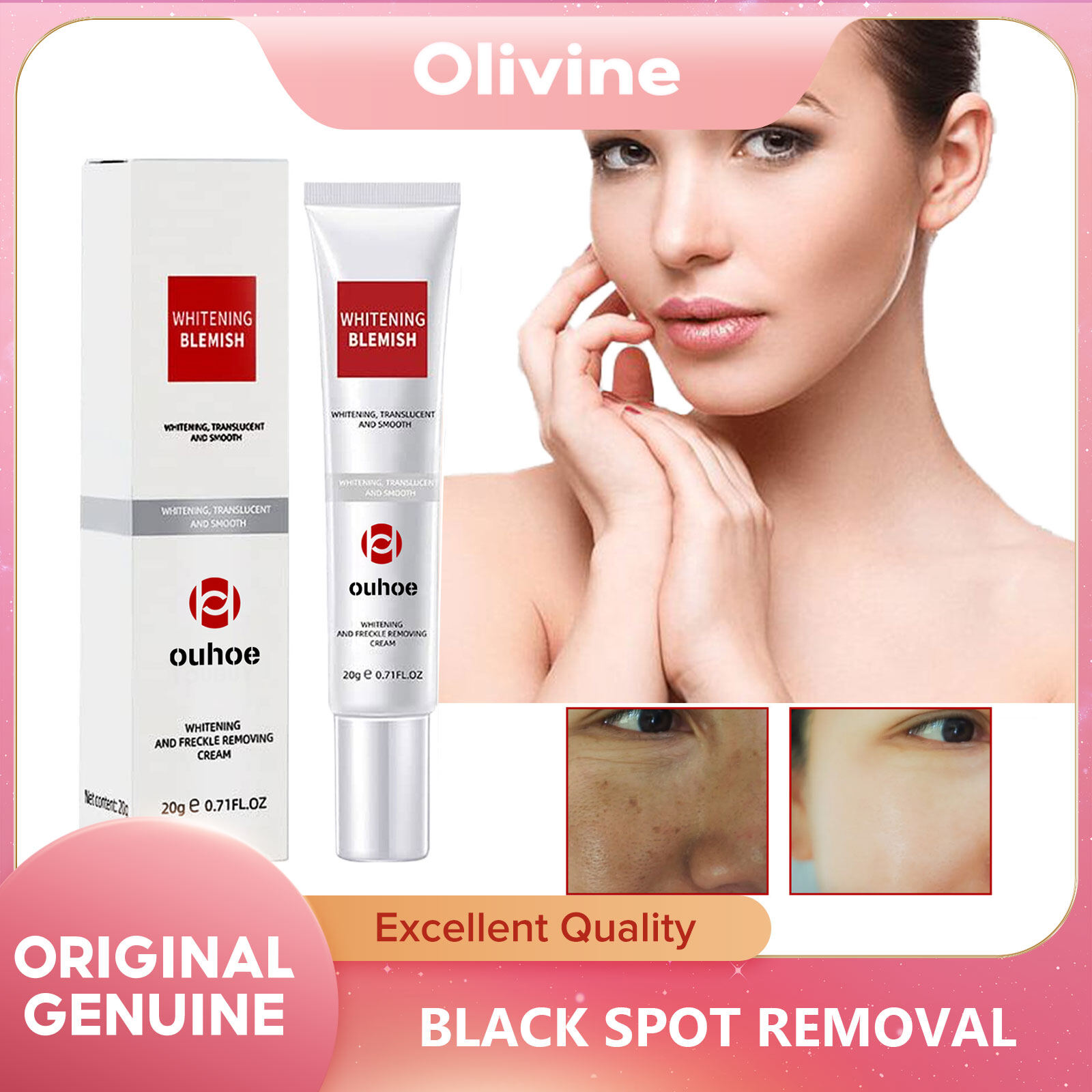 Ouanie black spot remover painless black spot remover spot remover face dark spot removal device anti-aging black spot remover sun freckle spot remover acne removal cream for removing freckle and facial spots C
