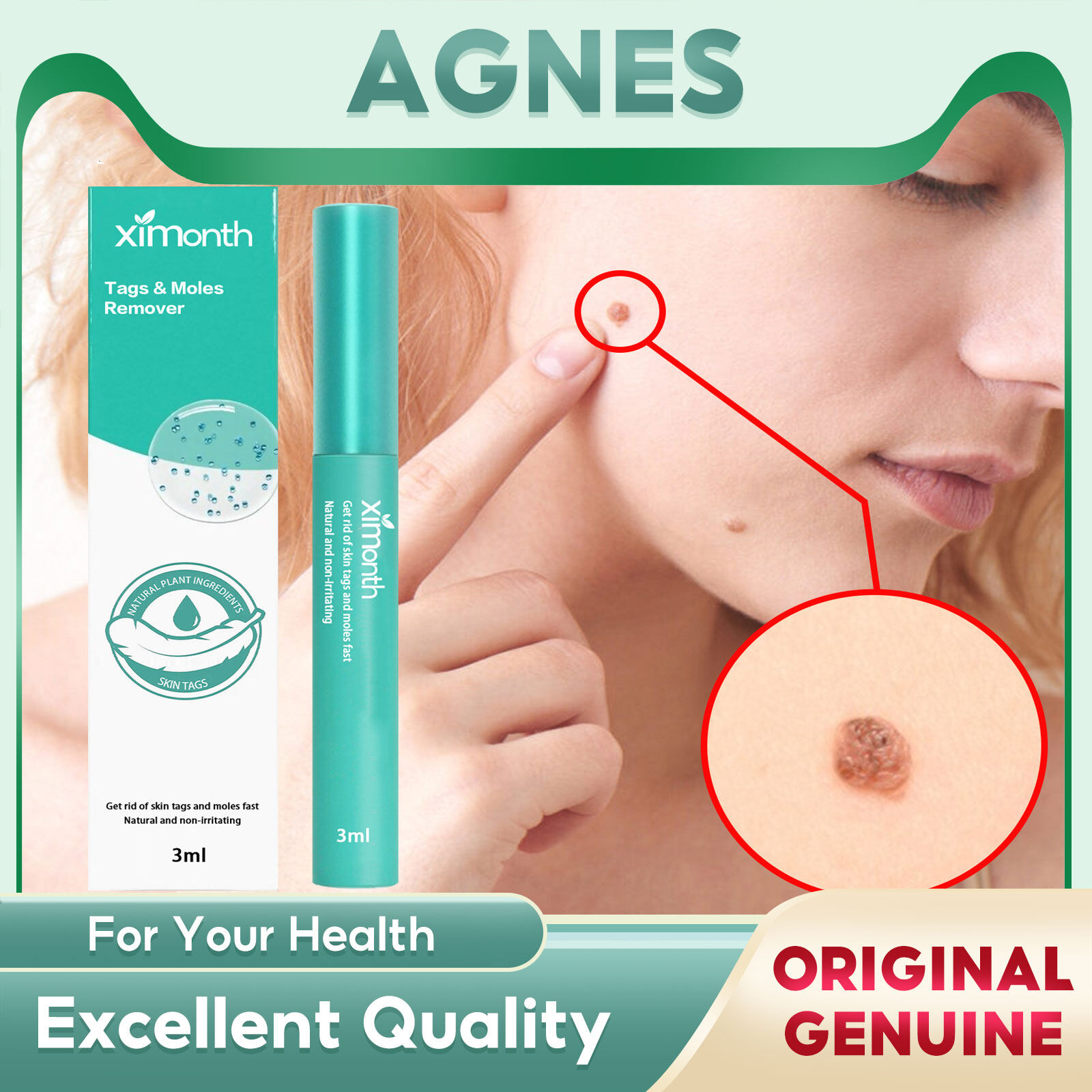 Ximonth Skin Tag Remover Kit Band Painless Mole Skin Tag Remover Pen Dot Corn Treatments Body Facial Beauty Tool Kit Auto Skin Tag Remover Painless Mole Remover With Cleansing Swabs Facial Beauty Tool Painless Effective