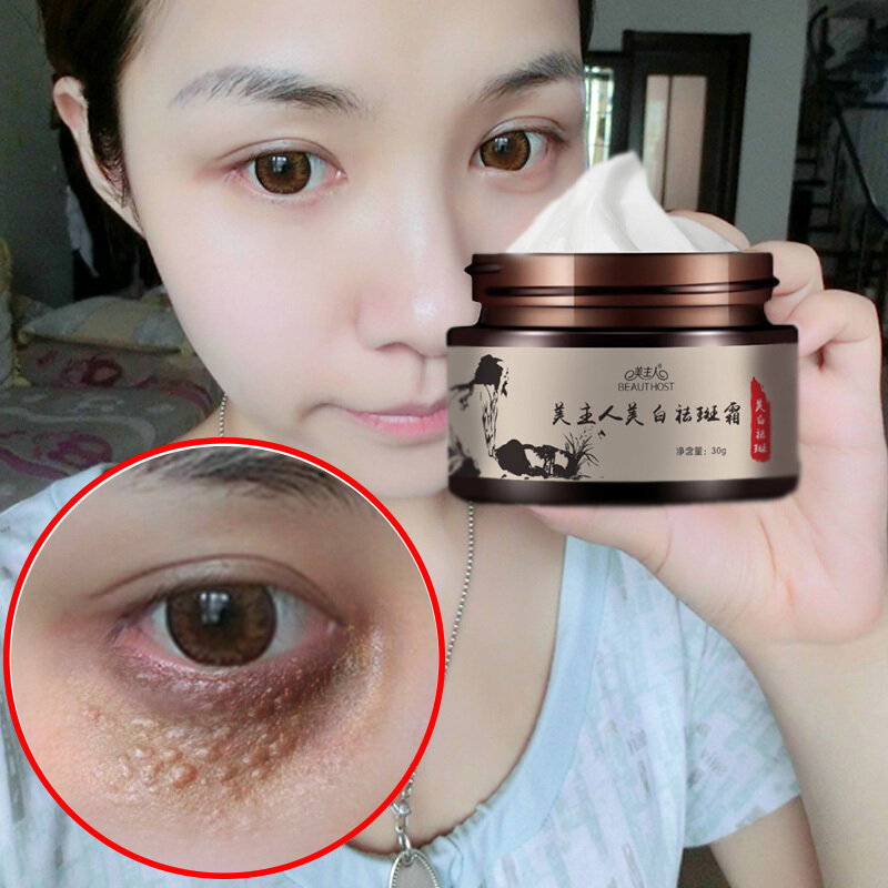 acne wrinkle cream