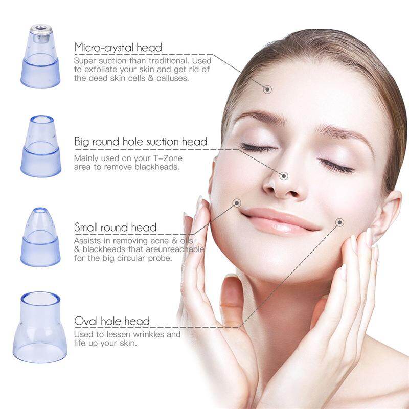 CkeyiN USB Rechargeable Vacuum Suction Blackhead Remover Facial Pore